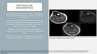MÉTODOS DE
DIAGNÓSTICO
En radiología no observaremos imágenes sugerentes de
MO hasta pasadas de dos a cuatro semanas del inicio de
los síntomas.
la ecografía es capaz de detectar cambios tempranos en
los tejidos blandos, precisa de completar el estudio con
otras pruebas de imagen que confirmen los patrones de
osificación característicos de la MO
La RMN es la técnica de imagen de elección para la
evaluación de tejidos blandos, y nos permitirá delimitar la
lesión.
La biopsia será necesaria en aquellos casos en los que las
imágenes no nos aporten un diagnóstico concluyente.
Miositisosificante.A propósito de un caso.(2022). Juncal,M. Simón, M. Vaca,P. Martín, S. Servicio de Cirugía ortopédica y Traumatología.Complejo Asistencial deZamora.Zamora (España).Recuperado Agosto 2023.
https://www.saludcastillayleon.es/CAZamora/es/publicaciones/revista-nuevo-hospital-2022/nuevo-hospital-2022-febrero-xviii-1/barrio-velasco-mj-simon-ochoa-m-vaca-fernandez-pl-martin-bl.ficheros/2104279-
NUEVOHOSPITAL
 