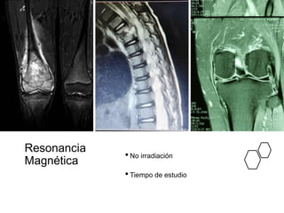 Resonancia
Magnética
•No irradiación
•Tiempo de estudio
 