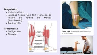 Historia clínica
Pruebas físicas: Gap test y prueba de
flexión de rodilla de Matles
(dorsiflexión)
Radiografía
Análgesicos
Cirugía
Diagnóstico
Tratamiento
 