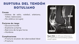 RUPTURA DEL TENDÓN
ROTULIANO
Atletas de salto, voleibol, atletismo,
fútbol, baloncesto
No atlético (cirugía)
Glucocorticoide
Explosive jumping
Ejercicio de largas horas
Hombres
Fractura avulsión de tuberosidad tibial
Fractura
Causas
Factores de riesgo
Complicaciones
 