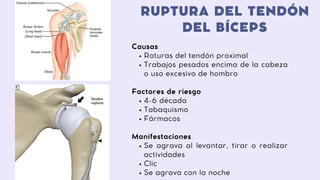 RUPTURA DEL TENDÓN
DEL BÍCEPS
Roturas del tendón proximal
Trabajos pesados encima de la cabeza
o uso excesivo de hombro
4-6 década
Tabaquismo
Fármacos
Se agrava al levantar, tirar o realizar
actividades
Clic
Se agrava con la noche
Causas
Factores de riesgo
Manifestaciones
 