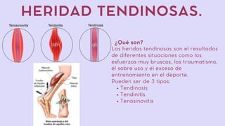 HERIDAD TENDINOSAS.
¿Qué son?
Tendinosis
Tendinitis
Tenosinovitis
Las heridas tendinosas son el resultados
de diferentes situaciones como los
esfuerzos muy bruscos, los traumatismo,
él sobre uso y el exceso de
entrenamiento en el deporte.
Pueden ser de 3 tipos:
 