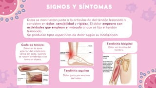 SIGNOS Y SÍNTOMAS
Codo de tenista:
Dolor en la zona
exterior del antebrazo,
cerca del codo, cuando
se rota el antebrazo o se
toma un objeto.
Estos se manifiestan junto a la articulación del tendón lesionado y
consisten en dolor, sensibilidad y rigidez. El dolor empeora con
actividades que emplean el músculo al que se fija el tendón
lesionado.
Se producen tipos específicos de dolor según su localización:
Tendinitis aquílea
Dolor justo por encima
del talón.
Tendinitis bicipital
Dolor en la zona del
hombro.
 