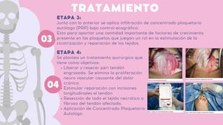 TRATAMIENTO
Junto con lo anterior se aplica infiltración de concentrado plaquetario
autólogo (PRP) bajo control ecográfico.
Esto para aportar una cantidad importante de factores de crecimiento
presente en las plaquetas que juegan un rol en la estimulación de la
cicatrización y reparación de los tejidos.
ETAPA 3:
03
Liberar y resecar peri tendón
engrosado. Se elimina la proliferación
neuro vascular causante del dolor
crónico.
Estimular reparación con incisiones
longitudinales el tendón
Resección de todo el tejido necrótico o
fibroso del tendón afectado.
Aplicación de Concentrado Plaquetario
Autológo.
Se plantea un tratamiento quirúrgico que
tiene como objetivos:
ETAPA 4:
04
 