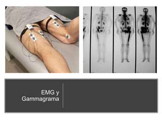 EMG y
Gammagrama
 