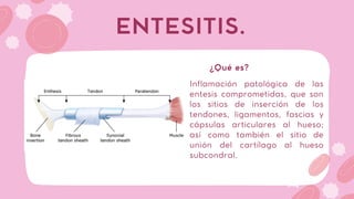 Inflamación patológica de las
entesis comprometidas, que son
los sitios de inserción de los
tendones, ligamentos, fascias y
cápsulas articulares al hueso;
así como también el sitio de
unión del cartílago al hueso
subcondral.
ENTESITIS.
¿Qué es?
 
