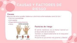Artritis reumatoide
Artropatía
Espondilitis anquilosante
Gota.
Algunas de estas pueden deberse a distintas enfermedades como lo son:
CAUSAS Y FACTORES DE
RIESGO
Causas
El estrés mecánico, es un factor central en
el desarrollo de la entesitis.
También un desencadenante es la respuesta
inmune innata.
Presente en pacientes más jóvenes y obesos.
Factores de riesgo
 