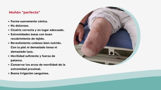 Forma suavemente cónica.
No doloroso.
Cicatriz correcta y en lugar adecuado.
Extremidades óseas con buen
recubrimiento de tejido.
Revestimiento cutáneo bien nutrido.
Con la piel ni demasiado tensa ni
demasiado laxa.
Movilidad suficiente y fuerza de
palanca.
Conservar los arcos de movilidad de la
extremidad proximal.
Buena irrigación sanguínea.
Muñón “perfecto”
 