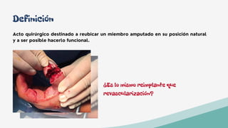 Definición
Acto quirúrgico destinado a reubicar un miembro amputado en su posición natural
y a ser posible hacerlo funcional.
¿Es lo mismo reimplante que
revascularización?
 