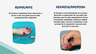 REIMPLANTE
El término reimplante hace referencia a
volver a unir una parte que ha sido
completamente amputada
El término revascularización se usa para
describir la reparación de una parte del
miembro que ha sido amputada de forma
incompleta, quedando unida por tejidos
blandos (piel, nervios o tendones) y que
precisa de la reparación vascular para
prevenir la necrosis.
REVASCULARIZACIÓN
 