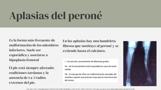 Es la forma más frecuente de
malformación de los miembros
inferiores. Suele ser
esporádica y asociarse a
hipoplasia femoral
En las aplasias hay una bandeleta
fibrosa que sustituye al peroné y se
extiende hasta el calcáneo.
El pie está siempre afectado:
coaliciones tarsianas y la
ausencia de 1 a 3 radios
externos del pie.
Aplasias del peroné
UCM. (2014). TEMA 9. MALFORMACIONES CONGÉNITAS DE INTERÉS ORTOPÉDICO. UCM.ES. HTTPS://WWW.UCM.ES/DATA/CONT/DOCS/420-2014-03-20-09%20MALFORMACIONES%20CONGENITAS.PDF
 