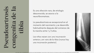 Es una afección rara, de etiología
desconocida, se asocia a la
neurofibromatosis.
La pseudoartrosis es excepcional en el
momento del nacimiento y se desarrolla
habitualmente después del comienzo de
la marcha entre 1 y 3 años.
Los niños nacen con una incurvación
anterior y en varo de la tibia (nunca hay
una incurvación posterior)
Pseudoartrosis
congenita
de
la
tibia
UCM. (2014). TEMA 9. MALFORMACIONES CONGÉNITAS DE INTERÉS ORTOPÉDICO. UCM.ES. HTTPS://WWW.UCM.ES/DATA/CONT/DOCS/420-2014-03-20-09%20MALFORMACIONES%20CONGENITAS.PDF
 
