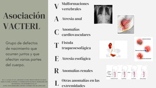 Asociación
VACTERL
V
Malformaciones
vertebrales
A Atresia anal
T
Fistula
traqueoesofágica
E Atresia esofágica
Grupo de defectos
de nacimiento que
ocurren juntos y que
afectan varias partes
del cuerpo.
C
Anomalías
cardiovasculares
R Anomalías renales
L
Otras anomalías en las
extremidades
MC, Á.-I., & CM, R.-M. (S/F). ASOCIACIÓN VACTERL. PRESENTACIÓN DE UN CASO EN
SESIÓN ANATOMO- PATOLÓGICA Y CONSIDERACIONES GENERALES. MEDIGRAPHIC.COM.
RECUPERADO EL 2 DE SEPTIEMBRE DE 2023, DE
HTTPS://WWW.MEDIGRAPHIC.COM/PDFS/ACTPEDMEX/APM-2017/APM175F.PDF
 