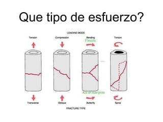 Que tipo de esfuerzo?
 