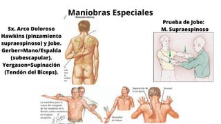 Maniobras Especiales
Sx. Arco Doloroso
Hawkins (pinzamiento
supraespinoso) y Jobe.
Gerber=Mano/Espalda
(subescapular).
Yergason=Supinación
(Tendón del Biceps).
Prueba de Jobe:
M. Supraespinoso
 