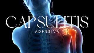 CAPSULITIS
A D H E S I V A
 