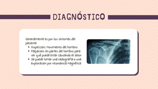 DIAGNÓSTICO
Inspección: movimiento del hombro
Palpación: en partes del hombro para
ver qué puede estar causando el dolor
Se puede tomar una radiografía o una
exploración por resonancia magnética
Generalmente es por los síntomas del
paciente
 