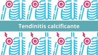 Tendinitis calcificante
 