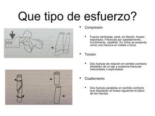 Que tipo de esfuerzo?
• Compresión
• Fuerza centrípeta, axial, sin flexión. Hueso
esponjoso. Fracturas por aplastamiento,
hundimiento, estallido. En niños se presenta
como una fractura en rodete o torus.
• Torsión
• Dos fuerzas de rotación en sentido contrario
alrededor de un eje y ocasiona fracturas
helicoidales o espiroideas.
• Cizallamiento
• Dos fuerzas paralelas en sentido contrario
que desplazan al hueso siguiendo el plano
de las fuerzas.
 