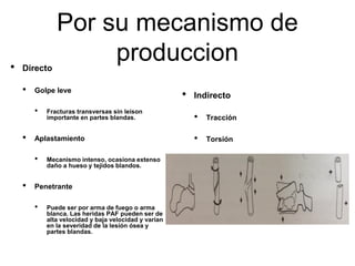 Por su mecanismo de
produccion
• Directo
• Golpe leve
• Fracturas transversas sin leison
importante en partes blandas.
• Aplastamiento
• Mecanismo intenso, ocasiona extenso
daño a hueso y tejidos blandos.
• Penetrante
• Puede ser por arma de fuego o arma
blanca. Las heridas PAF pueden ser de
alta velocidad y baja velocidad y varían
en la severidad de la lesión ósea y
partes blandas.
• Indirecto
• Tracción
• Torsión
• Flexión
• Compresión
• Cizallamiento
 