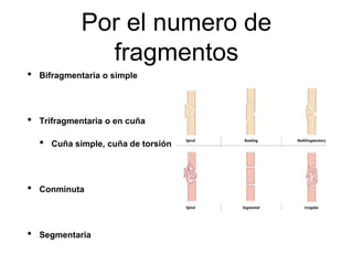 Por el numero de
fragmentos
• Bifragmentaria o simple
• Trifragmentaria o en cuña
• Cuña simple, cuña de torsión
• Conminuta
• Segmentaria
 