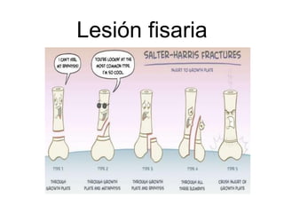 Lesión fisaria
 