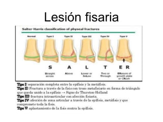 Lesión fisaria
 