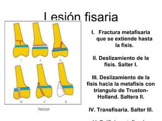 Lesión fisaria
I. Fractura metafisaria
que se extiende hasta
la fisis.
II. Deslizamiento de la
fisis. Salter I.
III. Deslizamiento de la
fisis hacia la metafisis con
triangulo de Truston-
Holland. Saltera II.
IV. Transfisaria. Salter III.
 