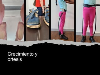Crecimiento y
ortesis
 