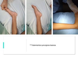 • Tratamientos quirurgicos basicos
 