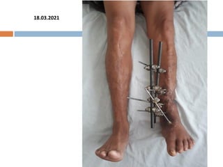 FOLLOW UP
18.03.2021
 