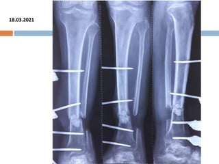 FOLLOW UP
18.03.2021
 