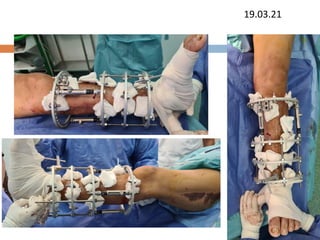 19.03.21
 