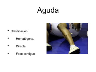Aguda
• Clasificación:
• Hematógena.
• Directa.
• Foco contiguo
 