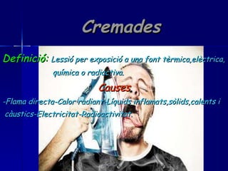 Cremades Definició:   Lessió per exposició a una font tèrmica,elèctrica, química o radiactiva. Causes -Flama directa-Calor radiant-Líquids inflamats,sòlids,calents i càustics-Electricitat-Radioactivitat. 