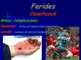 Ferides Classificació Greus: Complicacions: Generals:   Infecció-Hemorràgia important. Locals:   Lesions de nervis,tendons,músculs i ossos. Infecció de la ferida. 