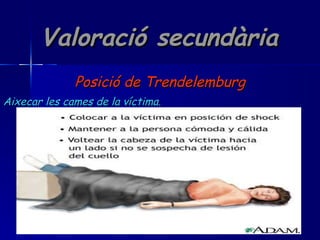 Valoració secundària Posició de Trendelemburg Aixecar les cames de la víctima. 