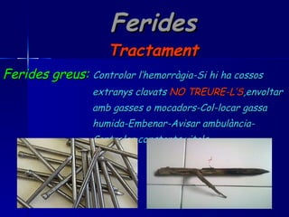 Ferides Tractament Ferides greus:   Controlar l’hemorràgia-Si hi ha cossos  extranys clavats  NO   TREURE-L’S ,envoltar amb gasses o mocadors-Col-locar gassa  humida-Embenar-Avisar ambulància- Controlar constants vitals. 