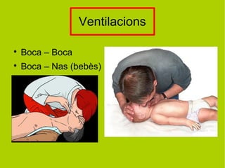 Ventilacions

Boca – Boca

Boca – Nas (bebès)
 