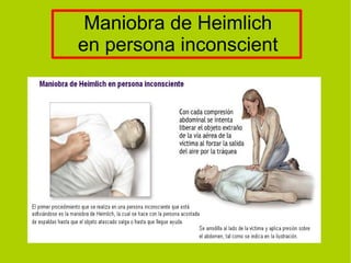 Maniobra de Heimlich
en persona inconscient
 
