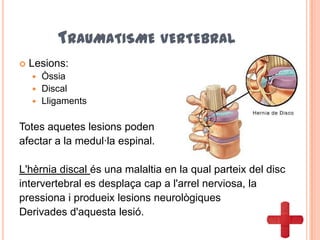 TRAUMATISME VERTEBRAL
 Lesions:
 Òssia
 Discal
 Lligaments
Totes aquetes lesions poden
afectar a la medul·la espinal.
L'hèrnia discal és una malaltia en la qual parteix del disc
intervertebral es desplaça cap a l'arrel nerviosa, la
pressiona i produeix lesions neurològiques
Derivades d'aquesta lesió.
 