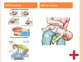 RCP en adults RCP en infants
 
