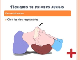 TÈCNIQUES DE PRIMERS AUXILIS
 Obrir les vies respiratòries
Vies respiratòries
 