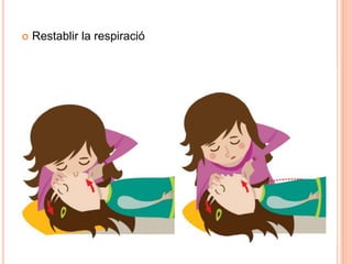  Restablir la respiració
 