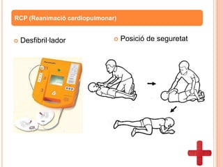  Desfibril·lador
RCP (Reanimació cardiopulmonar)
 Posició de seguretat
 