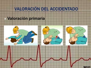 VALORACIÓN DEL ACCIDENTADO


Valoración primaria

 