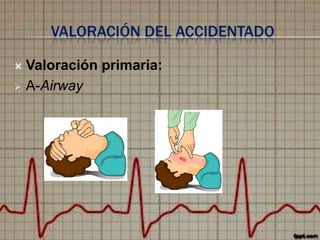 VALORACIÓN DEL ACCIDENTADO
Valoración primaria:
 A-Airway


 
