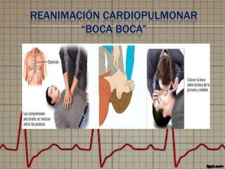REANIMACIÓN CARDIOPULMONAR
“BOCA BOCA”

 