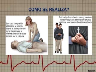 COMO SE REALIZA?

 