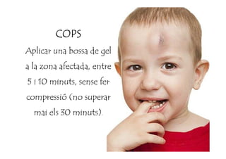 COPSCOPSCOPSCOPS
Aplicar una bossa de gel
a la zona afectada, entre
5 i 10 minuts, sense fer5 i 10 minuts, sense fer
compressió (no superar
mai els 30 minuts).
 